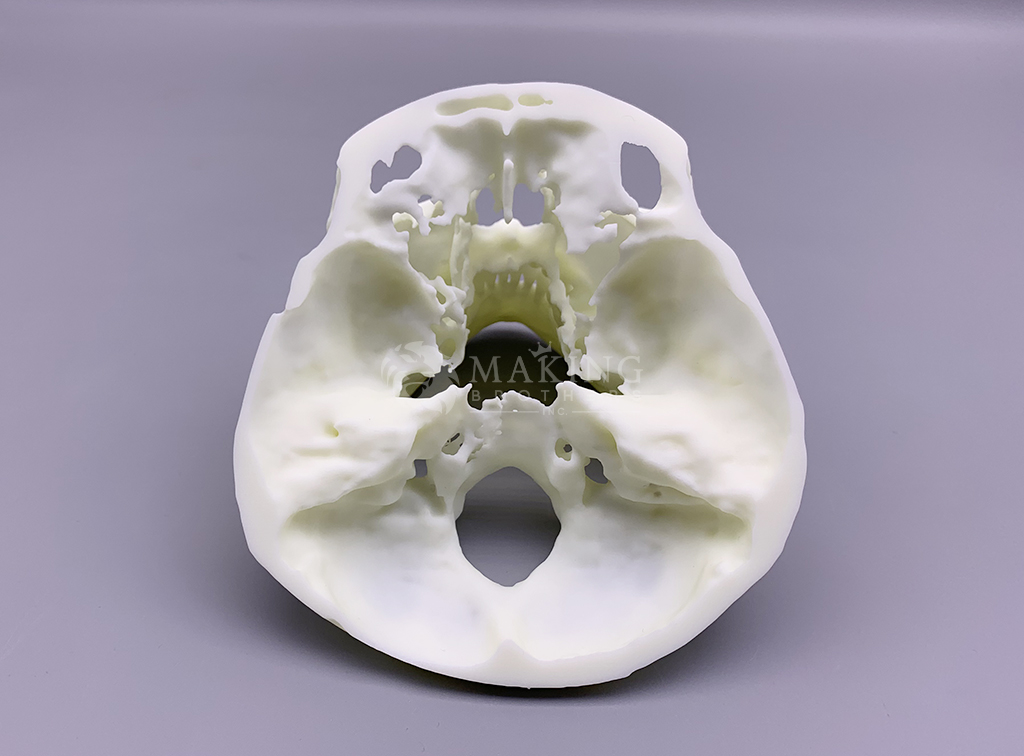 두개골3D프린팅-(7).jpg